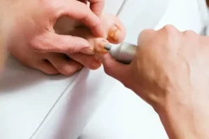 Realización de tratamiento de quiropodia.